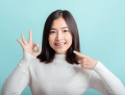 Kawat Gigi Solusi Tepat untuk Merapikan Gigi Open Bite