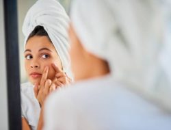 Hindari 5 Bahan Kosmetik Ini Agar Kulit Bebas Jerawat