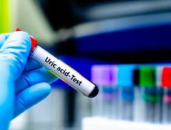 Jaga Kesehatan! Ketahui Kadar Asam Urat Normal Pria dan Wanita