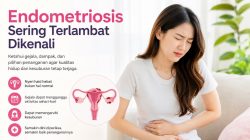 Mengapa Banyak Wanita Terlambat Menyadari Endometriosis? Ini Faktanya