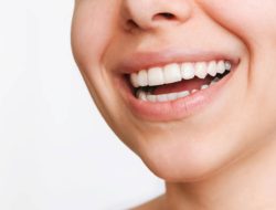 Perbedaan Bleaching dan Scaling Gigi: Fungsi dan Manfaatnya