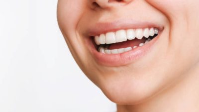 Perbedaan Bleaching dan Scaling Gigi: Fungsi dan Manfaatnya